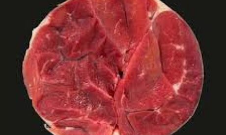Shin of Beef (1.00 kg)